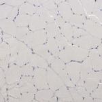 CKAP4 Antibody in Immunohistochemistry (IHC)