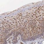 CKAP4 Antibody in Immunohistochemistry (IHC)