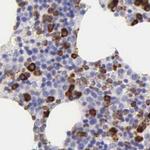 CKAP4 Antibody in Immunohistochemistry (IHC)