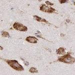 CKAP4 Antibody in Immunohistochemistry (IHC)