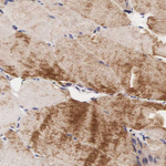 UPRT Antibody in Immunohistochemistry (Paraffin) (IHC (P))