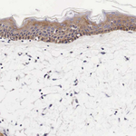 UPRT Antibody in Immunohistochemistry (Paraffin) (IHC (P))