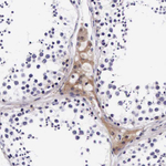UPRT Antibody in Immunohistochemistry (Paraffin) (IHC (P))