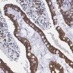 WDR89 Polyclonal Antibody