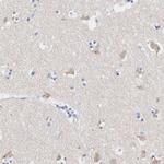 ASPHD2 Polyclonal Antibody