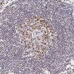 CCDC117 Antibody in Immunohistochemistry (Paraffin) (IHC (P))