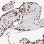 CCDC117 Antibody in Immunohistochemistry (Paraffin) (IHC (P))