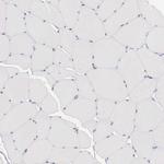 CCDC117 Antibody in Immunohistochemistry (Paraffin) (IHC (P))