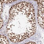CCDC117 Antibody in Immunohistochemistry (Paraffin) (IHC (P))