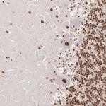 POLR2F Antibody in Immunohistochemistry (Paraffin) (IHC (P))