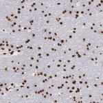 Histone 1F0 Antibody in Immunohistochemistry (Paraffin) (IHC (P))