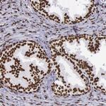 Histone 1F0 Antibody in Immunohistochemistry (IHC)