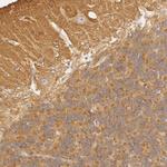 RALGAPA1 Antibody in Immunohistochemistry (Paraffin) (IHC (P))