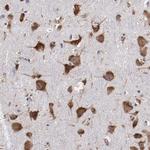 RPS4X Antibody in Immunohistochemistry (Paraffin) (IHC (P))