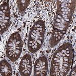 RPS4X Antibody in Immunohistochemistry (Paraffin) (IHC (P))