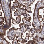 RPS4X Antibody in Immunohistochemistry (Paraffin) (IHC (P))