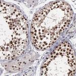 C14orf130 Antibody in Immunohistochemistry (Paraffin) (IHC (P))