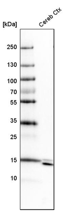 SYNJ2BP Antibody in Western Blot (WB)