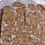 eIF5 Antibody in Immunohistochemistry (Paraffin) (IHC (P))