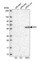 eIF5 Antibody in Western Blot (WB)