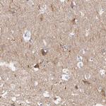 CEP170B Antibody in Immunohistochemistry (Paraffin) (IHC (P))