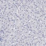CEP170B Antibody in Immunohistochemistry (Paraffin) (IHC (P))