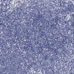 CEP170B Antibody in Immunohistochemistry (Paraffin) (IHC (P))