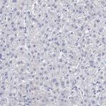 CEP170B Antibody in Immunohistochemistry (IHC)