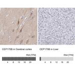 CEP170B Antibody