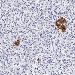 DGCR2 Polyclonal Antibody