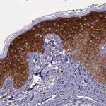 AHNAK2 Antibody in Immunohistochemistry (Paraffin) (IHC (P))