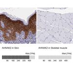 AHNAK2 Antibody in Immunohistochemistry (IHC)