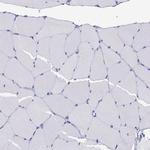 AHNAK2 Antibody in Immunohistochemistry (IHC)