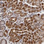 FRMD7 Polyclonal Antibody