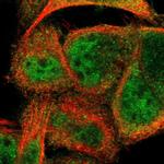 CCDC22 Polyclonal Antibody