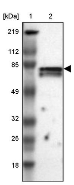 CCDC22 Antibody in Western Blot (WB)