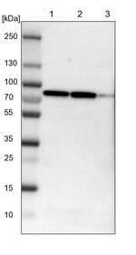 CCDC22 Antibody in Western Blot (WB)