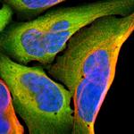 AHA1 Antibody in Immunocytochemistry (ICC/IF)