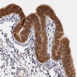 AHA1 Antibody in Immunohistochemistry (Paraffin) (IHC (P))