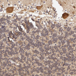 AHA1 Antibody in Immunohistochemistry (Paraffin) (IHC (P))