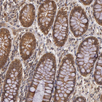 AHA1 Antibody in Immunohistochemistry (Paraffin) (IHC (P))
