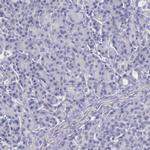 THSD7A Polyclonal Antibody