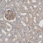 THSD7A Antibody in Immunohistochemistry (IHC)