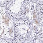 THSD7A Antibody in Immunohistochemistry (IHC)
