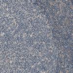 THSD7A Antibody in Immunohistochemistry (IHC)