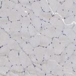 TRMT5 Antibody in Immunohistochemistry (Paraffin) (IHC (P))