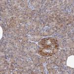 ANGEL1 Antibody in Immunohistochemistry (Paraffin) (IHC (P))