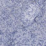 PYGL Antibody in Immunohistochemistry (Paraffin) (IHC (P))
