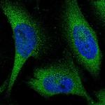 KLHL28 Polyclonal Antibody