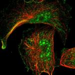 ARMCX5 Polyclonal Antibody